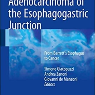 Adenocarcinoma of the Esophagogastric Junction by Simone Giacopuzzi, ISBN-13: 978-3319287744