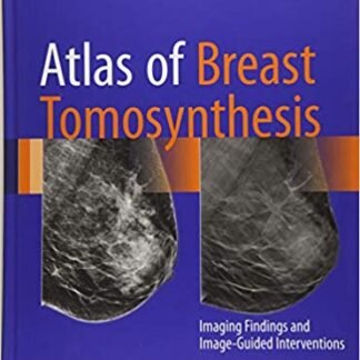 Atlas of Breast Tomosynthesis: Imaging Findings and Image-Guided Interventions, ISBN-13: 978-3319215655