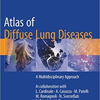 Atlas of Diffuse Lung Diseases: A Multidisciplinary Approach, ISBN-13: 978-3319427508