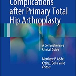 Complications after Primary Total Hip Arthroplasty: A Comprehensive Clinical Guide, ISBN-13: 978-3319549118