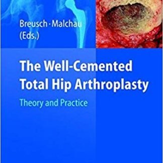 The Well-Cemented Total Hip Arthroplasty: Theory and Practice, ISBN-13: 978-3540241973